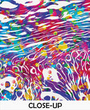 Skin Melanoma Histology Watercolor Print Medical Art Science Art Integumentary Epidermis Histology Biology Art Skin Skin Cancer Poster-1198