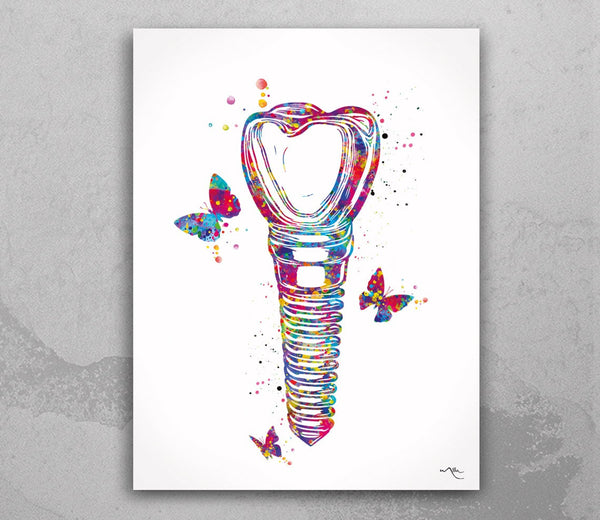 Dental Implant Art Watercolor Print Tooth Anatomical Dental Clinic Decor Dentistry Student Science Graduaiton Dentist Gift Doctor Art-721