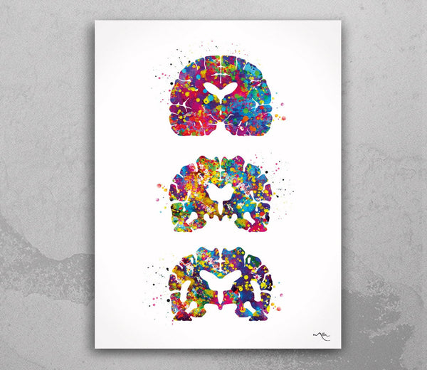 Alzheimers Disease Watercolor Print Medical Art Science Art Wall Decor Wall Art Neurology Human Brain Neurologist Science Wall Hanging-1642