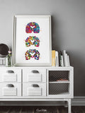 Alzheimers Disease Watercolor Print Medical Art Science Art Wall Decor Wall Art Neurology Human Brain Neurologist Science Wall Hanging-1642 - CocoMilla