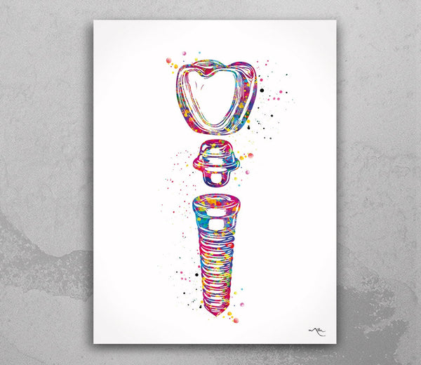 Dental Implant Art Watercolor Print Tooth Anatomical Dental Clinic Decor Dentistry Student Science Graduaiton Dentist Gift Doctor Art-317