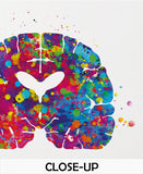 Alzheimers Disease Watercolor Print Medical Art Science Art Wall Decor Wall Art Neurology Human Brain Neurologist Science Wall Hanging-1642 - CocoMilla