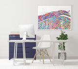 Psoriasis Pathology Watercolor Print Epidermis Histology Dermatology Skin Cell Clinic Medical Art Dermatologist Office Skin Diseases-2321