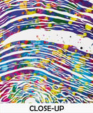 Psoriasis Pathology Watercolor Print Epidermis Histology Dermatology Skin Cell Clinic Medical Art Dermatologist Office Skin Diseases-2321