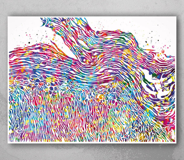 Eczema Pathology Watercolor Print Epidermis Histology Dermatology Skin Cell Clinic Medical Art Dermatologist Office Skin Diseases Art-2322