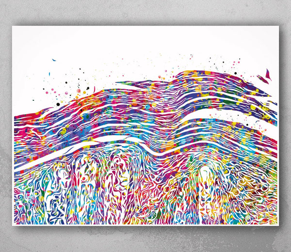 Psoriasis Pathology Watercolor Print Epidermis Histology Dermatology Skin Cell Clinic Medical Art Dermatologist Office Skin Diseases-2321