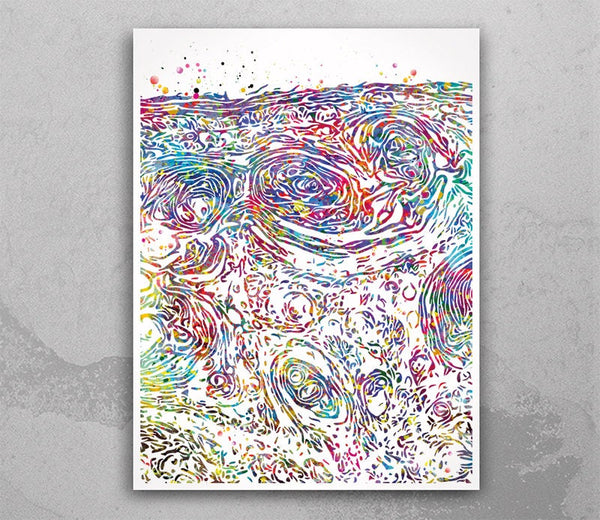 Squamous Cell Carcinoma Watercolor Print Skin Histology Science Art Epidermis Dermatology Medical Art Dermatologist Gift Clinic Decor-2336