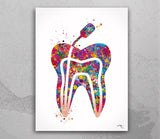Root Canal Treatment Watercolor Print Endodontic Therapy Tooth Dental Clinic Decor Art Dentistry Office Medical Graduaiton Dentist Gift-1672