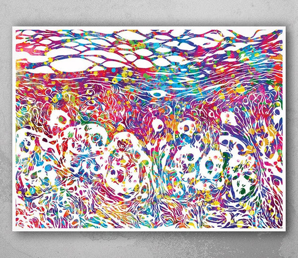 Skin Melanoma Histology Watercolor Print Medical Art Science Art Integumentary Epidermis Histology Biology Art Skin Skin Cancer Poster-1198