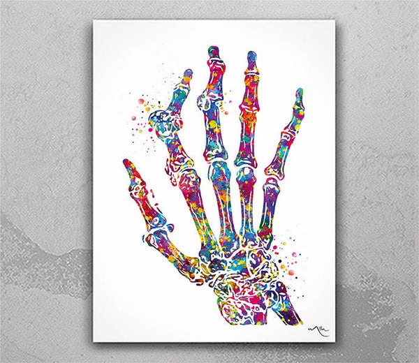 Rheumatoid Arthritis Hand Bone Watercolor Print Carpal Bones  Skeletal Hand Rheumatology Medical Art Orthopedic Art Nurse Clinic Decor-2491
