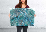 Uterus Histology Watercolor Print Uterine Gynecology Medical Gynecologist OBGYN Female Reproductive System Medical Art Gift Office Decor-491