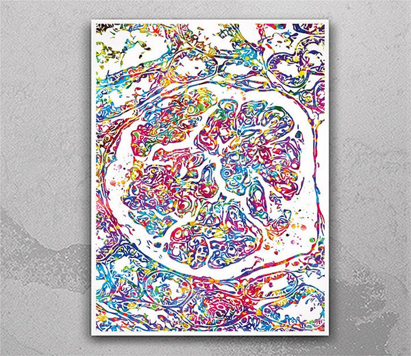 Lupus Nephritis Wall Art Watercolor Print Lupus Awareness Immune Disease Rheumatology Medical Art Lupus Warrior Art Nurse Clinic Decor-2492
