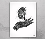 Kidney Transplant Watercolor Print Nephrology Organ Donor Gift Gift Dialysis Nurse Medical Art Transplant Survivor Hemodialysis Gift-2586