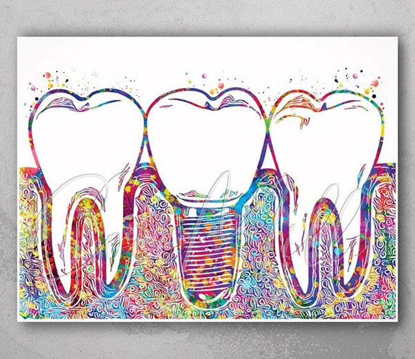 Dental Implant Art Watercolor Print Tooth Anatomical Dental Clinic Decor Dentistry Student Science Graduaiton Dentist Gift Doctor Art-238