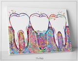 Dental Implant Art Watercolor Print Tooth Anatomical Dental Clinic Decor Dentistry Student Science Graduaiton Dentist Gift Doctor Art-238 - CocoMilla