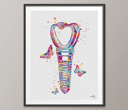 Dental Implant Art Watercolor Print Tooth Anatomical Dental Clinic Decor Dentistry Student Science Graduaiton Dentist Gift Doctor Art-721 - CocoMilla