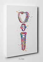 Dental Implant Art Watercolor Print Tooth Anatomical Dental Clinic Decor Dentistry Student Science Graduaiton Dentist Gift Doctor Art-317 - CocoMilla