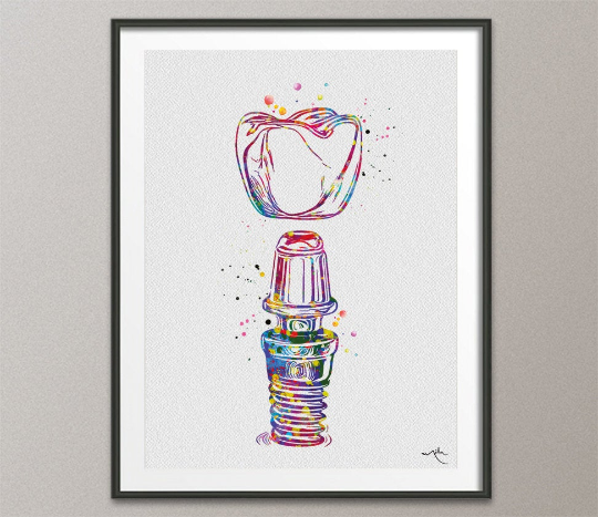 Dental Implant Art Watercolor Print Tooth Anatomical Dental Clinic Decor Dentistry Student Science Graduaiton Dentist Gift Doctor Art-1093 - CocoMilla