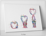Dental Implant Art Watercolor Print Tooth Anatomical Dental Clinic Decor Dentistry Student Science Graduaiton Dentist Gift Doctor Art-563 - CocoMilla