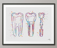 Implant Line Art Watercolor Print Tooth Office Art Dental implant Clinic Decor Dentistry Student Science Graduaiton Dentist Gift Doctor-1253 - CocoMilla