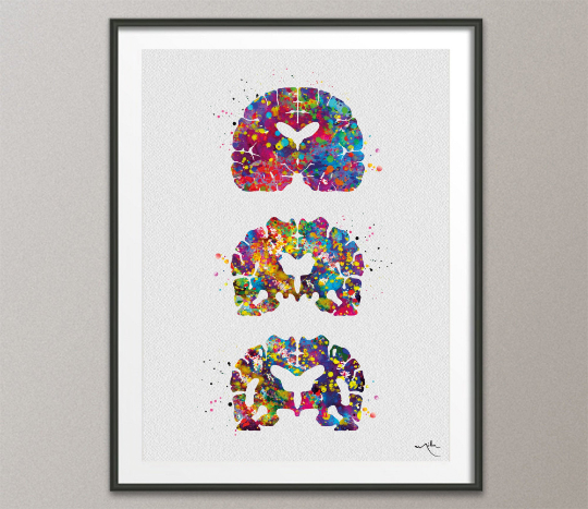 Alzheimers Disease Watercolor Print Medical Art Science Art Wall Decor Wall Art Neurology Human Brain Neurologist Science Wall Hanging-1642 - CocoMilla